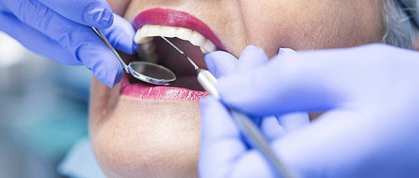 Best Emergency Wisdom Tooth Extraction in Candor, NC